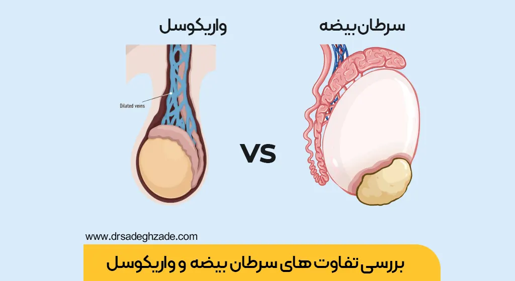 آیا کیست بیضه خود به خود از بین میرود؟