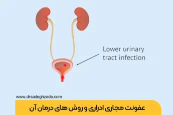 عفونت ادراری